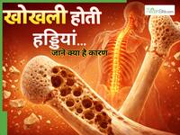 ये 5 चीजें खाने-पीने से खोखली होती हैं हड्डियां, गलती से भी न करें ज्यादा सेवन