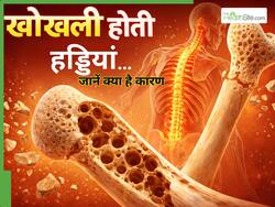 ये 5 चीजें खाने-पीने से खोखली होती हैं हड्डियां, गलती से भी न करें ज्यादा सेवन