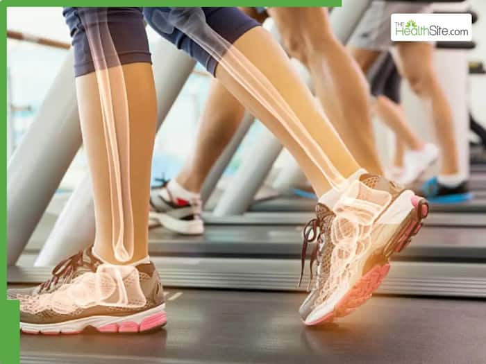 Why bone health is crucial for women at every stage of life, expert explains