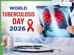 World Tuberculosis Day 2026: Early warning signs of TB you should never ignore