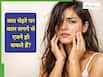 सिर के उड़ते बाल चेहरे पर आने से पिंपल्स क्यों होते हैं? जानें कारण और ठीक करने के तरीके
