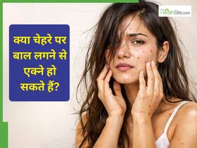 सिर के उड़ते बाल चेहरे पर आने से पिंपल्स क्यों होते हैं? जानें कारण और ठीक करने के तरीके
