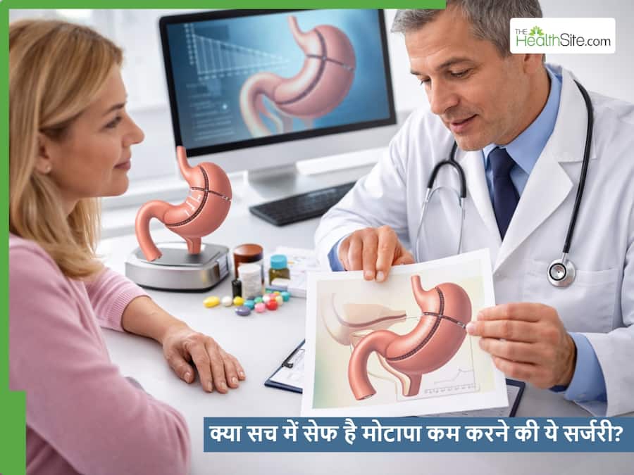 Bariatric Surgery: क्या सच में सेफ है वजन घटाने वाली सर्जरी? जीवन में क्या आते हैं बदलाव