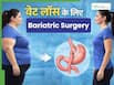बैरिएट्रिक सर्जरी: मोटापा कम करने के लिए कब दी जाती है इस सर्जरी को करवाने की सलाह?