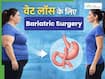 बैरिएट्रिक सर्जरी: मोटापा कम करने के लिए कब दी जाती है इस सर्जरी को करवाने की सलाह?
