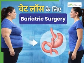 बैरिएट्रिक सर्जरी: मोटापा कम करने के लिए कब दी जाती है इस सर्जरी को करवाने की सलाह?