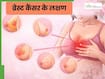 ब्रेस्ट कैंसर शुरू होने पर नजर आते हैं ये 5 लक्षण, 90 फीसदी महिलाएं कर देती हैं नजरअंदाज
