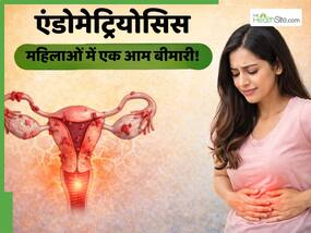 एंडोमेट्रियोसिस क्या है? महिलाओं में क्यों आम बनती जा रही है यह बीमारी, जानें इसके बारे में सबकुछ