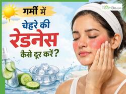 गर्मी में चेहरे की रेडनेस कैसे दूर करें?