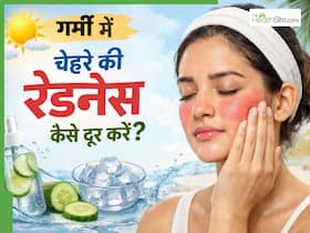 गर्मी में चेहरे की रेडनेस कैसे दूर करें?