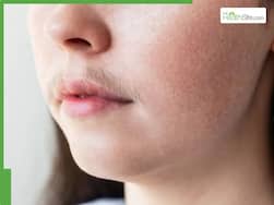 5 best natural oils to reduce facial hair growth at home naturally