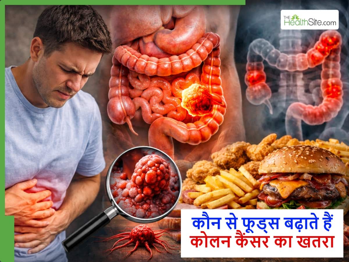 कोलन कैंसर खतरा बढ़ाने वाले आम फूड्स जिन्हें लोग ज्यादा खा रहे हैं
