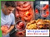 Colon Cancer: आजकल खाए जाने वाले ये फूड्स जो बढ़ा रहे कोलन कैंसर का खतरा, लेकिन खूब खा रहे लोग