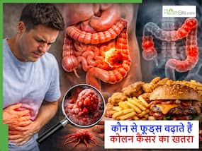 Colon Cancer: आजकल खाए जाने वाले ये फूड्स जो बढ़ा रहे कोलन कैंसर का खतरा, लेकिन खूब खा रहे लोग