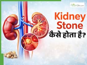 किडनी में पथरी कैसे बनती है? जानें इस बीमारी के लक्षण, कारण और इलाज क्या हैं