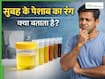 Morning Urine का रंग क्या बताता है? 5 संकेत जो किडनी खराबी की ओर करते हैं इशारा