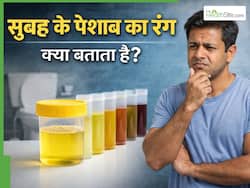 Morning Urine का रंग क्या बताता है? 5 संकेत जो किडनी खराबी की ओर करते हैं इशारा