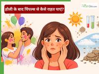 होली खेलने के बाद चेहरे पर हो गए पिंपल्स और मुंहासे? डॉ. चांदनी जैन बता रही हैं इससे छुटकारा पाने का तरीका