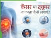 कैंसर और ट्यूमर में क्या अंतर है? क्या हर ट्यूमर कैंसर होता है- जानें डॉक्टर से