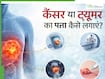 कैंसर और ट्यूमर में क्या अंतर है? क्या हर ट्यूमर कैंसर होता है- जानें डॉक्टर से