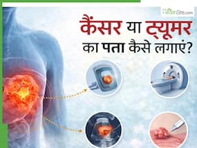 कैंसर और ट्यूमर में क्या अंतर है? क्या हर ट्यूमर कैंसर होता है- जानें डॉक्टर से