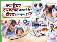 बालों के लिए हेयर ट्रांसप्लांट करा रहे हैं? जानिए क्या इससे कैंसर हो सकता है या नहीं