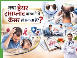 बालों के लिए हेयर ट्रांसप्लांट करा रहे हैं? जानिए क्या इससे कैंसर हो सकता है या नहीं