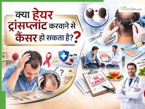 बालों के लिए हेयर ट्रांसप्लांट करा रहे हैं? जानिए क्या इससे कैंसर हो सकता है या नहीं