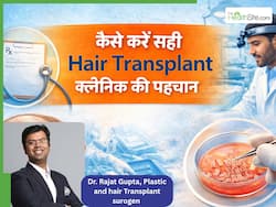 हेयर ट्रांसप्लांट के लिए क्लीनिक सही या नहीं? पता लगाने के लिए डॉक्टर की पर्ची पर चेक करें ये चीज