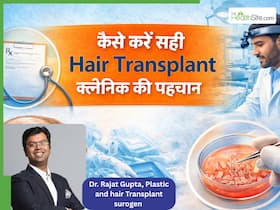 हेयर ट्रांसप्लांट के लिए क्लीनिक सही या नहीं? पता लगाने के लिए डॉक्टर की पर्ची पर चेक करें ये चीज