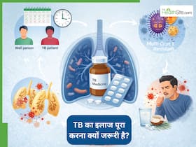टीबी की दवा अधूरी छोड़ी तो बढ़ सकता है खतरा, डॉक्टर ने बताया क्यों जरूरी है पूरा कोर्स टीबी की दवा अधूरी छोड़ी तो बढ़ सकता है खतरा, डॉक्टर ने बताया क्यों जरूरी है पूरा कोर्स