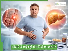 हर्निया से लेकर फैटी लिवर तक, मोटापे के कारण होने लगता है इन गंभीर बीमारियों का खतरा