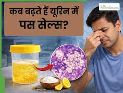 यूरिन में Pus Cells बढ़ने का क्या मतलब है? किन बीमारियों का होता है संकेत
