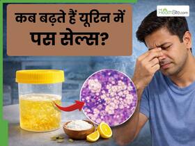 यूरिन में Pus Cells बढ़ने का क्या मतलब है? किन बीमारियों का होता है संकेत