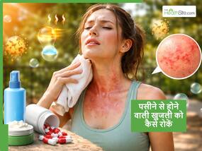 Sweating in Summer: गर्मियों में ज्यादा पसीने के कारण बार-बार होने वाली एलर्जी से छुटकारा कैसे पाएं?