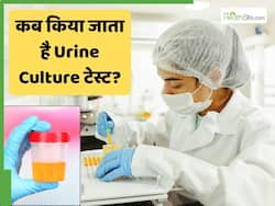 Urine Culture टेस्ट क्या है और कब कराया जाता है?