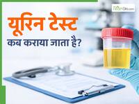 यूरिन टेस्ट की मदद से किन बीमारियों का पता चलता है? जानें कब देते हैं डॉक्टर इस टेस्ट को कराने की जरूरत