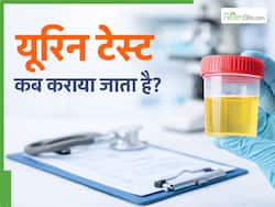 यूरिन टेस्ट की मदद से किन बीमारियों का पता चलता है? जानें कब देते हैं डॉक्टर इस टेस्ट को कराने की जरूरत