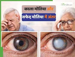 काला मोतिया और सफेद मोतिया में क्या अंतर है? क्या दोनों बीमारियों में अंधा हो जाता है इंसान?