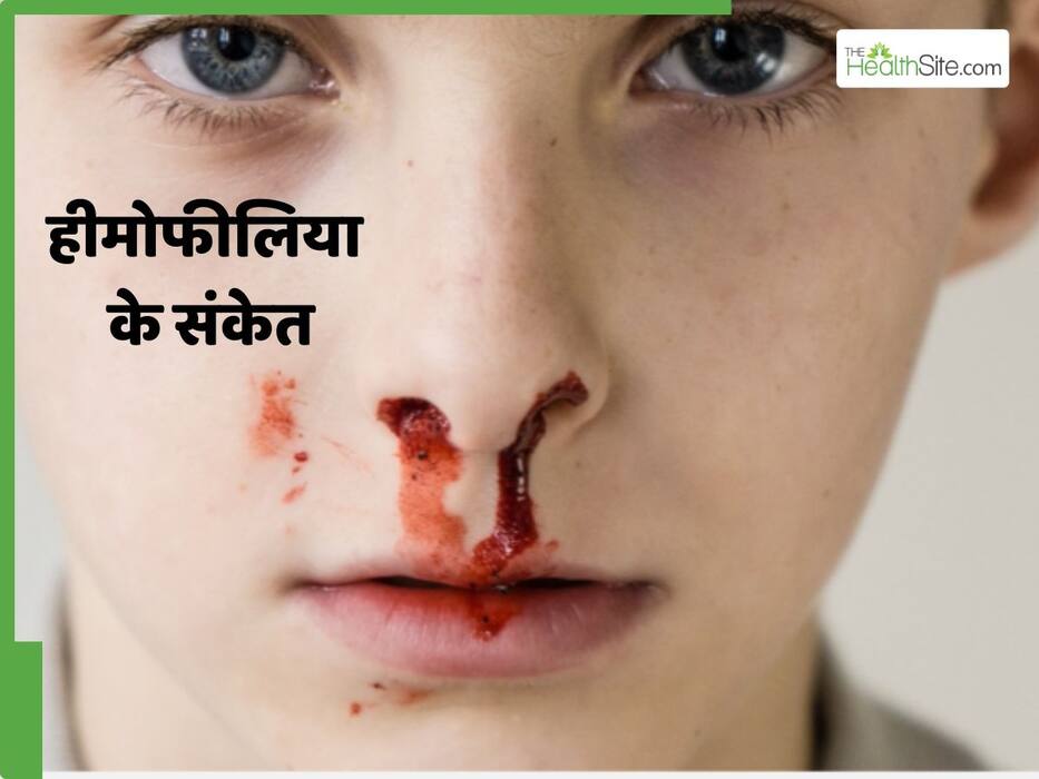हीमोफीलिया के इन 4 लक्षणों को न समझें नॉर्मल, छिपे हुए संकेतों का जरूरी है समय पर इलाज
