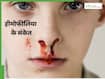 हीमोफीलिया के इन 4 लक्षणों को न समझें नॉर्मल, छिपे हुए संकेतों का जरूरी है समय पर इलाज