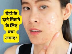 धूल-मिट्टी की वजह से चेहरे पर दाने हो रहे हैं तो लगाएं ये 5 चीजें, मिल सकता है फायदा