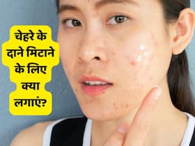 धूल-मिट्टी की वजह से चेहरे पर दाने हो रहे हैं तो लगाएं ये 5 चीजें, मिल सकता है फायदा