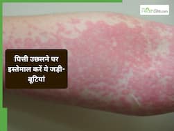 पित्ती उछलने से राहत पाने के लिए इन 5 जड़ी-बूटियों का इस्तेमाल, खुजली और जलन होगी कम