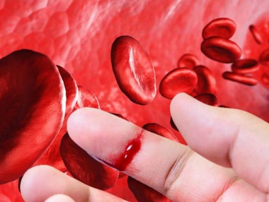 हीमोफीलिया के इन 4 लक्षणों को न समझें नॉर्मल, छिपे हुए संकेतों का जरूरी है समय पर इलाज