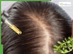 5 powerful home remedies to strengthen hair roots and prevent hair fall naturally