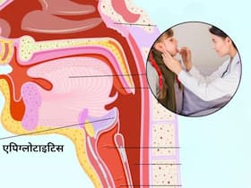 गले में दर्द और सांस लेने में दिक्कत? हो सकता है एक्यूट एपिग्लोटाइटिस, WHO ने बताए कारण और लक्षण
