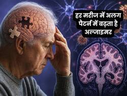 हर मरीज में एक जैसा नहीं बढ़ता अल्जाइमर , स्टडी में सामने आए 3 अलग पैटर्न