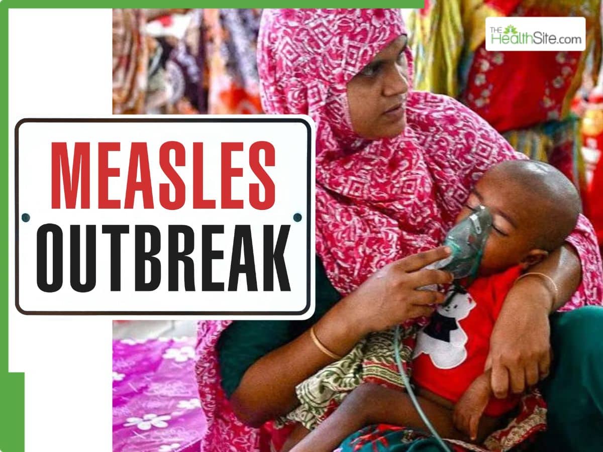 Measles Crisis Deepens in Bangladesh: Children's Lives at Risk | Quick Digest
