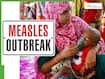 Bangladesh Measles Outbreak: 145 dead, 533 hospitalised in 24 hours - Should India be worried about cross-border transmission?
